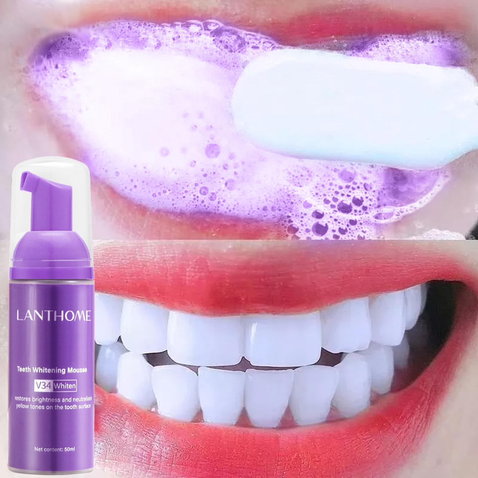 Teeth Whitening Cream - V34 Köpük Diş Temizleme Diş Macunu