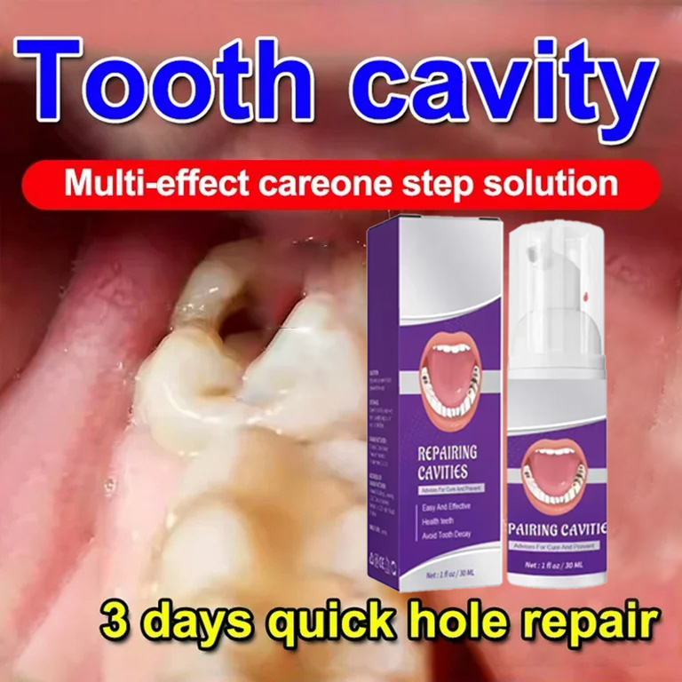 Teeth Whitening Cream - Diş Temizleme Diş Macunu Diş Lekelerini