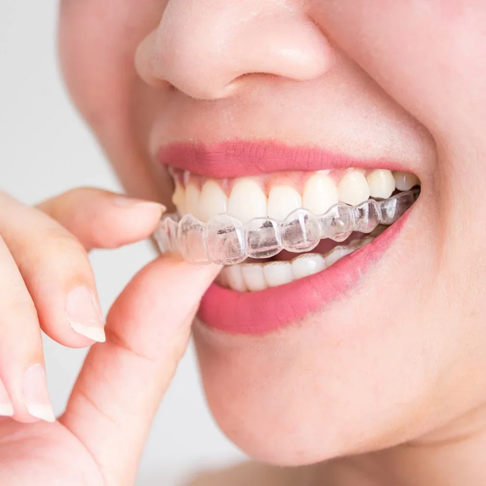 1-4 Adet Horlama Önleyici Bruk - Teeth Whitening Mouth Guard incelemesi ve fiyatı