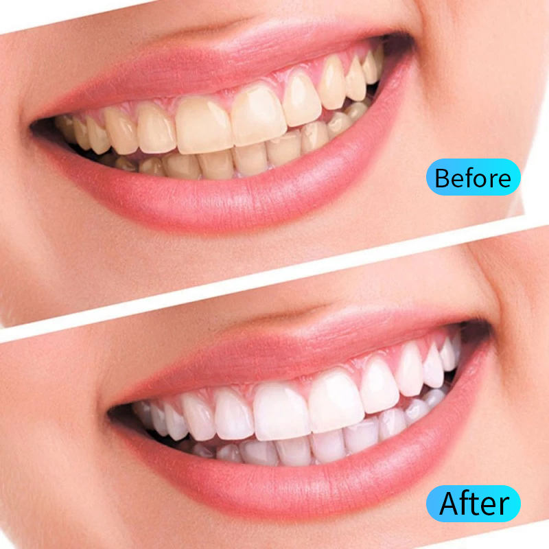 Diş Beyazlatma Jeli Seti Ağız  - Teeth Whitening Opalescence incelemesi ve fiyatı