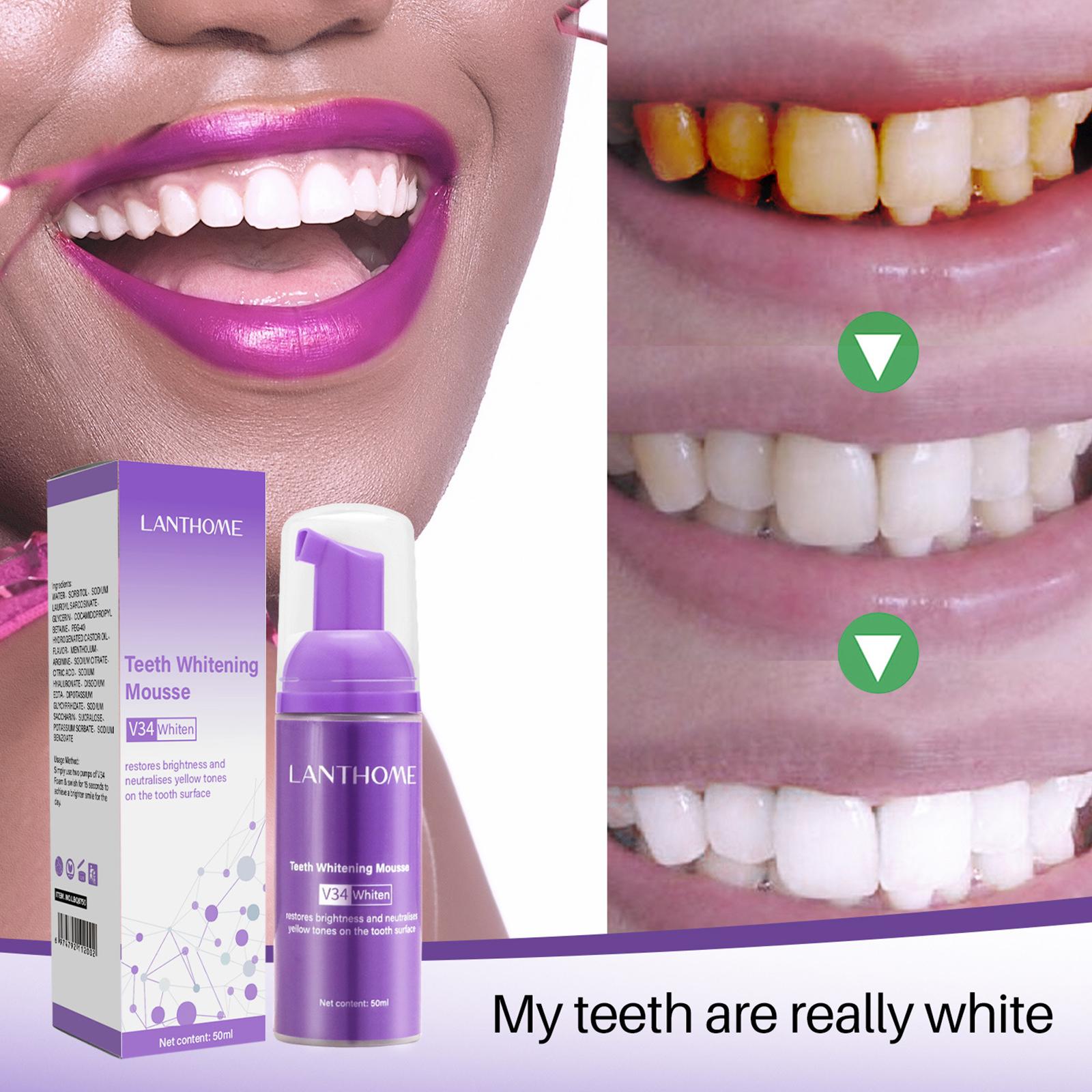 V34 Köpük Diş Temizleme Diş Ma - Teeth Whitening Cream incelemesi ve fiyatı