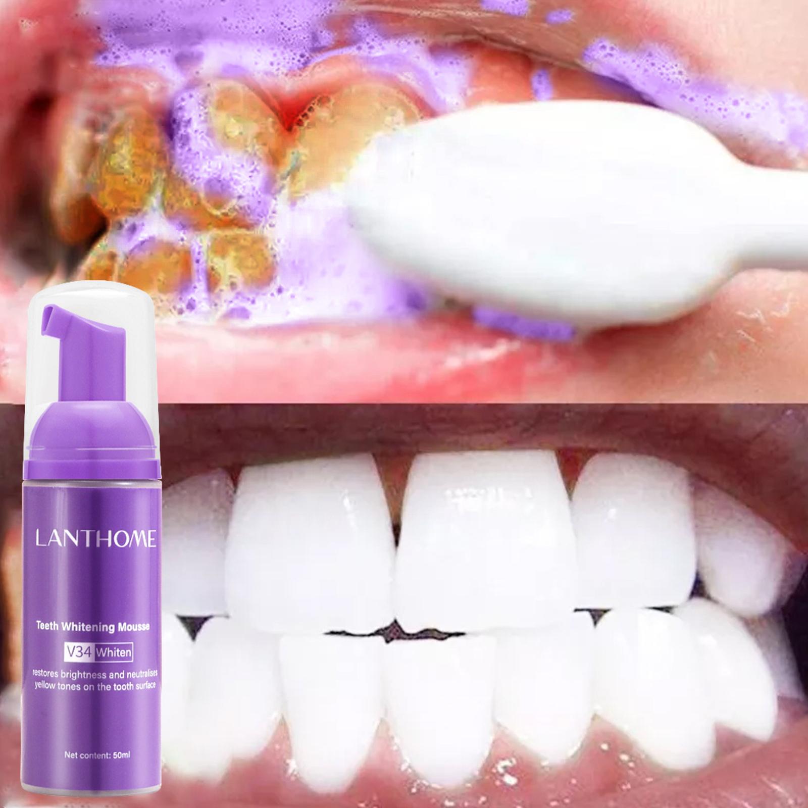 V34 Köpük Diş Temizleme Diş Ma - Teeth Whitening Cream incelemesi ve fiyatı