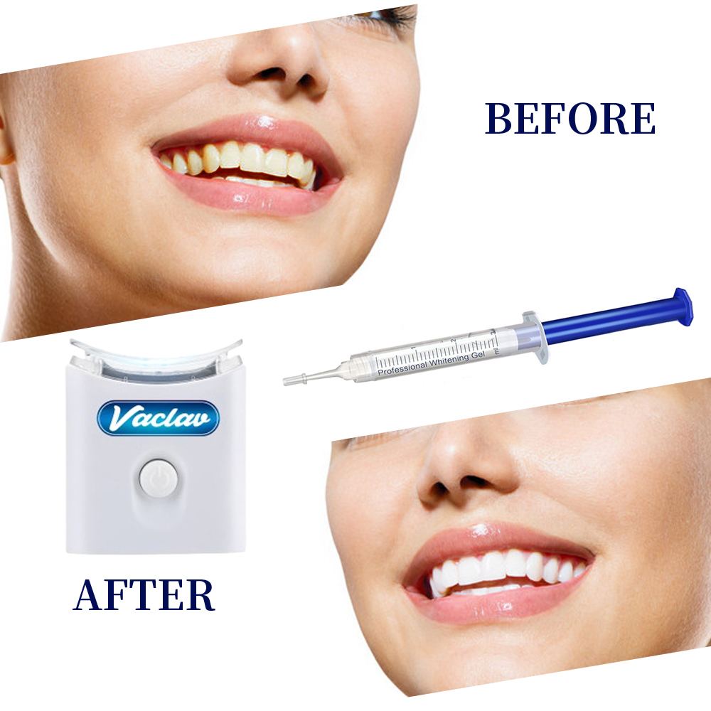 Nane Diş Beyazlatma Jeli Şırın - Teeth Whitening Kit At Home incelemesi ve fiyatı