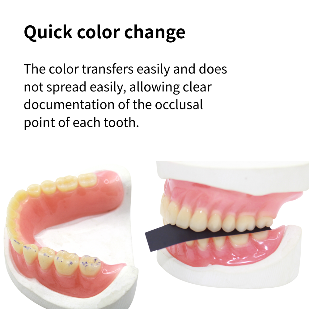 AG 300 Yaprak/Kutu Diş Artikül - Teeth Whitening Uk incelemesi ve fiyatı