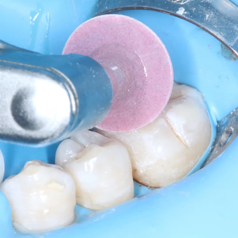 40 adet diş parlatma diski kom - Teeth Whitening Uk incelemesi ve fiyatı