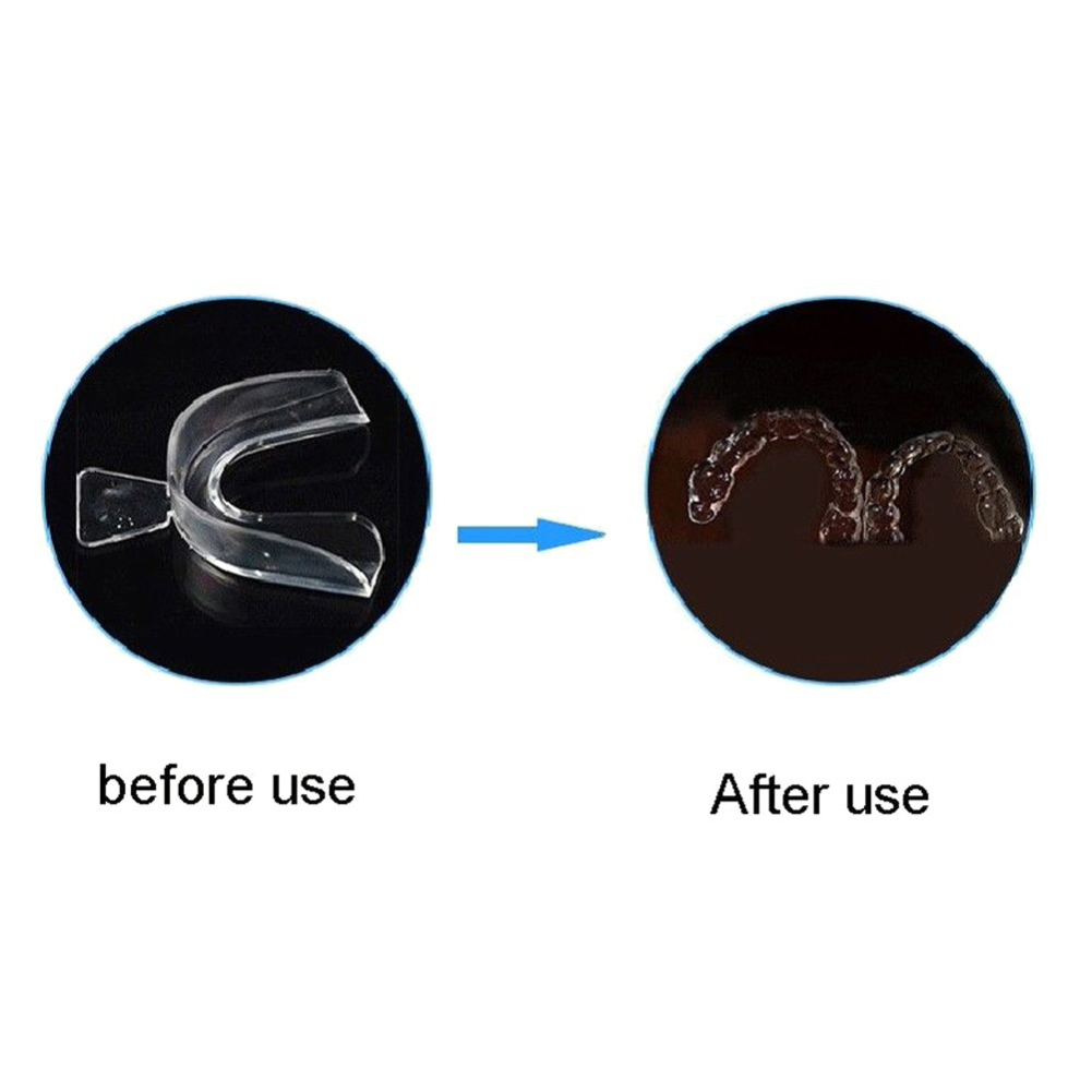 2/4 adet yumuşak diş ortodonti - Teeth Whitening Mouth Guard incelemesi ve fiyatı