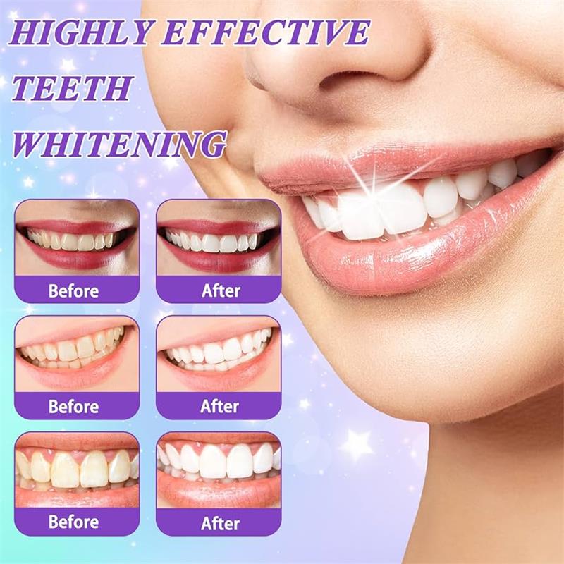 9D Mor Diş Beyazlatıcı Diş Mac - Teeth Whitening Cream incelemesi ve fiyatı