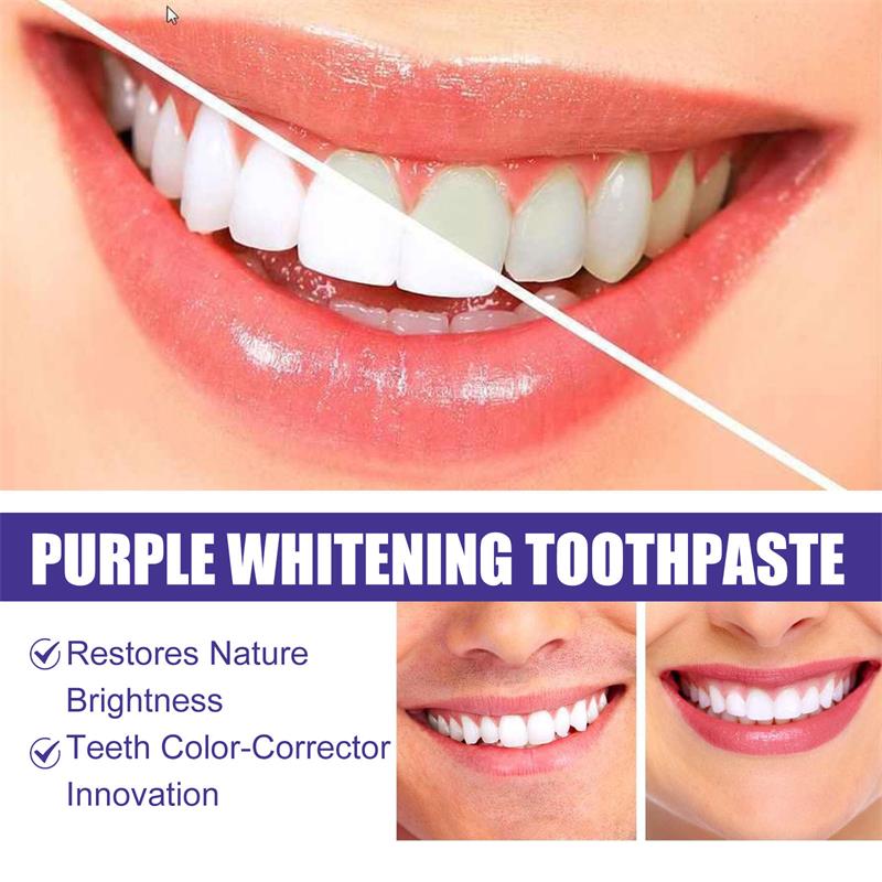 9D Mor Diş Beyazlatıcı Diş Mac - Teeth Whitening Cream incelemesi ve fiyatı