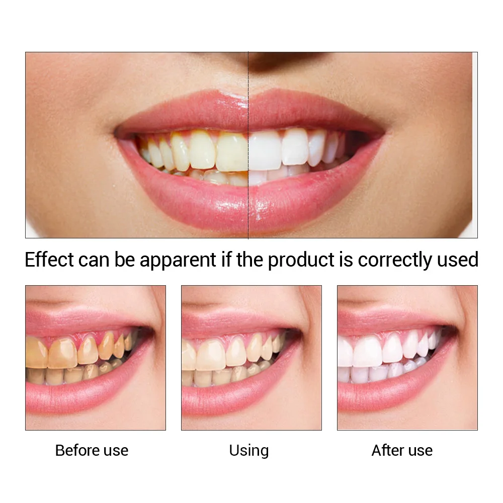 FTEENPLY diş beyazlatma özü to - Teeth Whitening Essence incelemesi ve fiyatı
