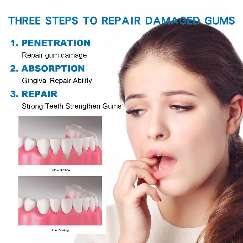 Diğer Diğer Diş Bakım Ürünleri - Teeth Whitening Cream incelemesi ve fiyatı