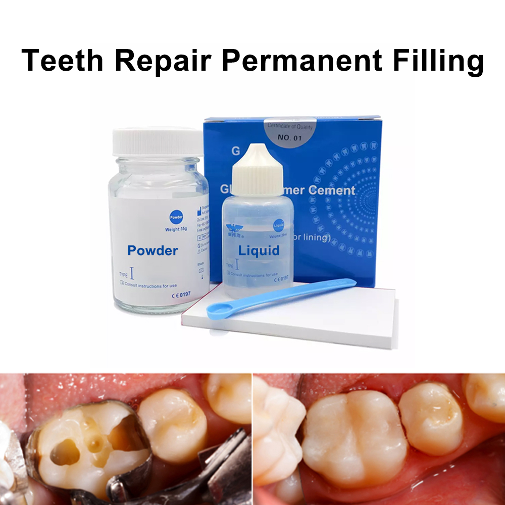Kalıcı diş doldurma tamir kiti - Teeth Whitening Kit At Home incelemesi ve fiyatı