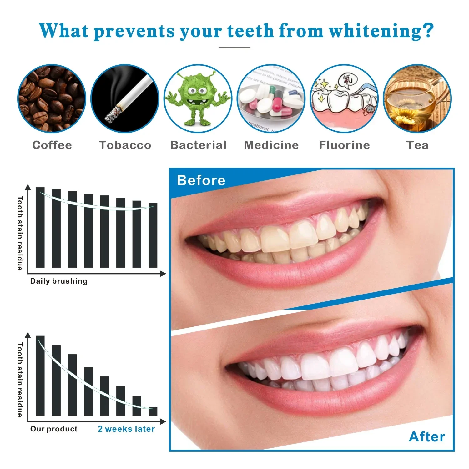 14/28 adet 3D Diş Beyazlatma Ş - Teeth Whitening Effects incelemesi ve fiyatı