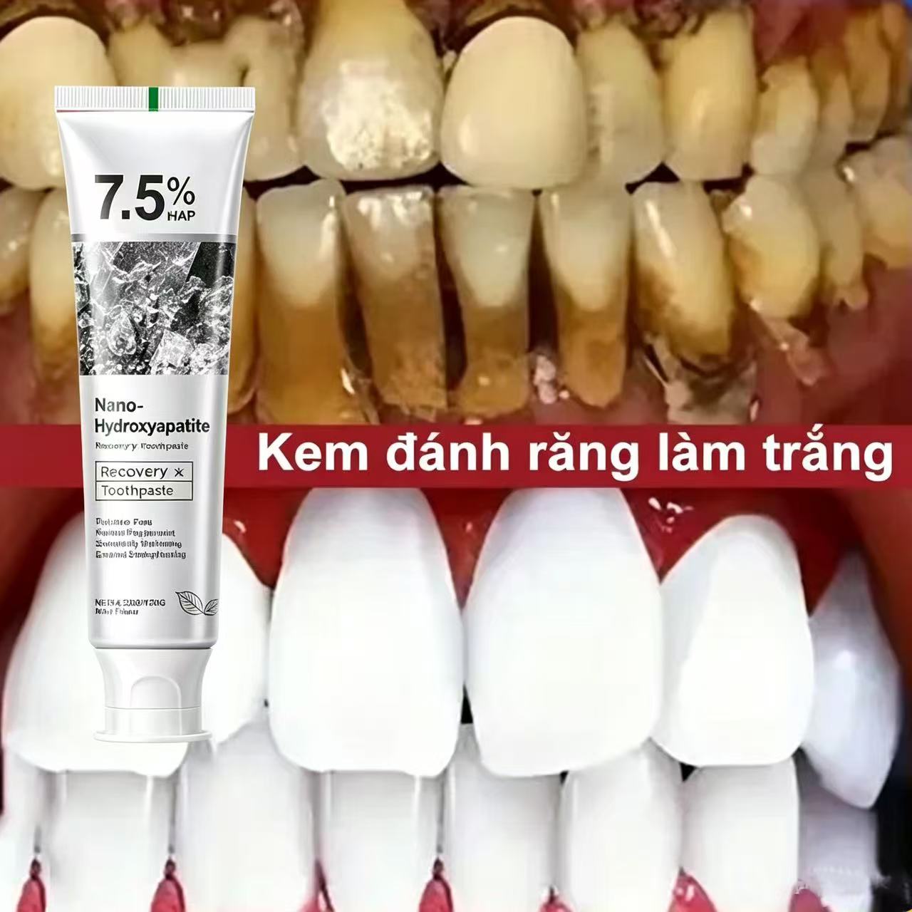 %7,5 Hidroksiapatit Probiyotik - Teeth Whitening Cream incelemesi ve fiyatı