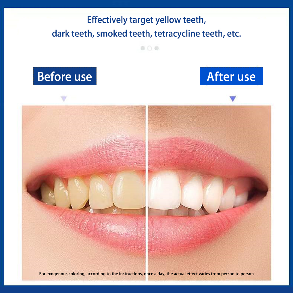 70/140 Pairs 5D beyaz diş beya - Teeth Whitening Effects incelemesi ve fiyatı