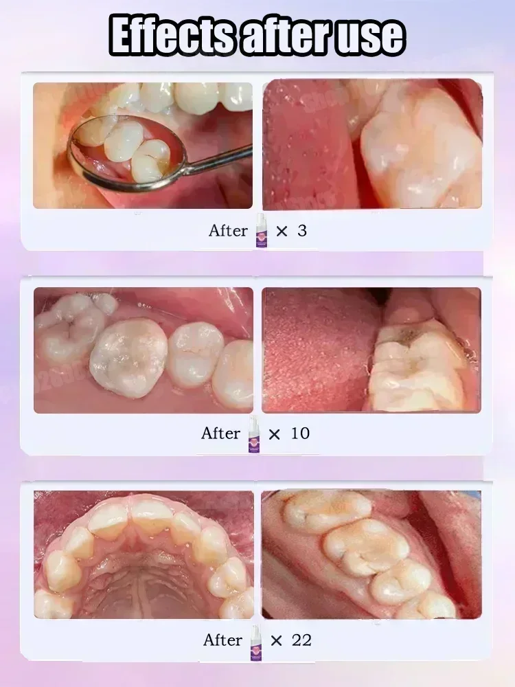 Diş Temizleme Diş Macunu Diş L - Teeth Whitening Cream incelemesi ve fiyatı
