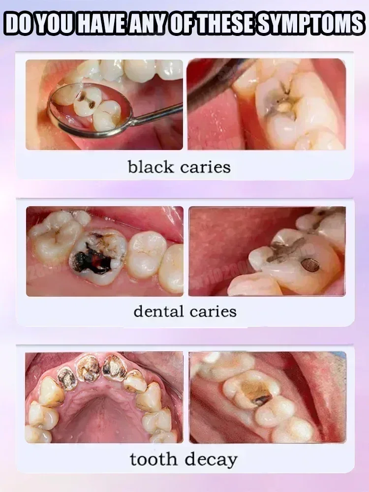 Diş Temizleme Diş Macunu Diş L - Teeth Whitening Cream incelemesi ve fiyatı